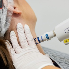 Clearlift treatment on neck